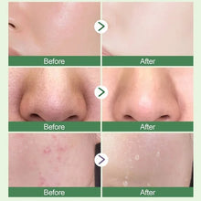 Load image into Gallery viewer, 【LAST DAY SALE】Green Tea Cleansing Mask