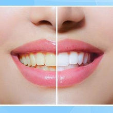 Load image into Gallery viewer, 【🔥 Buy 1 Get 1 Free】 Teeth Whitening Pen