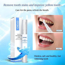 Load image into Gallery viewer, 【🔥 Buy 1 Get 1 Free】 Teeth Whitening Pen