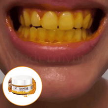 Load image into Gallery viewer, ModernMint™ Turmeric Teeth Whitening Powder 【LIMITED TIME 65% OFF SALE】