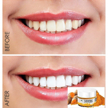 Load image into Gallery viewer, ModernMint™ Turmeric Teeth Whitening Powder 【LIMITED TIME 65% OFF SALE】