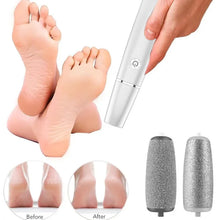 Load image into Gallery viewer, 【LAST DAY SALE】Electric Foot Callus Remover
