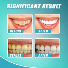 Load image into Gallery viewer, 【LAST DAY PROMOTION】 - Intensive Stain Removal Teeth Whitening Toothpaste
