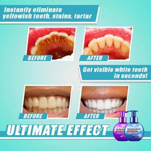 Load image into Gallery viewer, 【LAST DAY PROMOTION】 - Intensive Stain Removal Teeth Whitening Toothpaste
